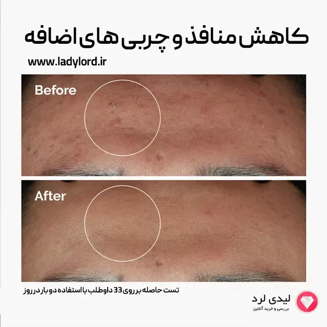 سرم پوست دی اوردینری مدل zinc1% niacinamide10%  حجم 30 میلی لیتر