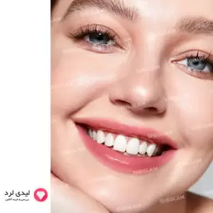 رژ لب بالمی رنگی براق مدل Glow Addict شیگلم مدل Peach Juice