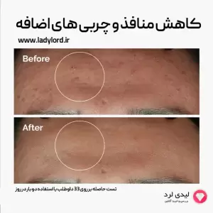 سرم پوست دی اوردینری مدل zinc1% niacinamide10%  حجم 30 میلی لیتر